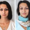 грыжа межпозвоночного диска поясничного отдела