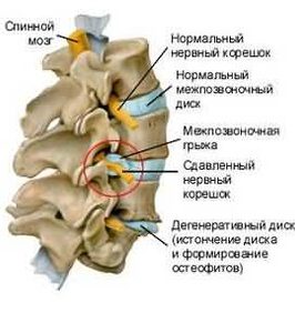 Строение шейного отдела позвоночника